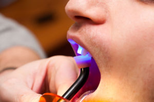 A person with blue light on their mouth